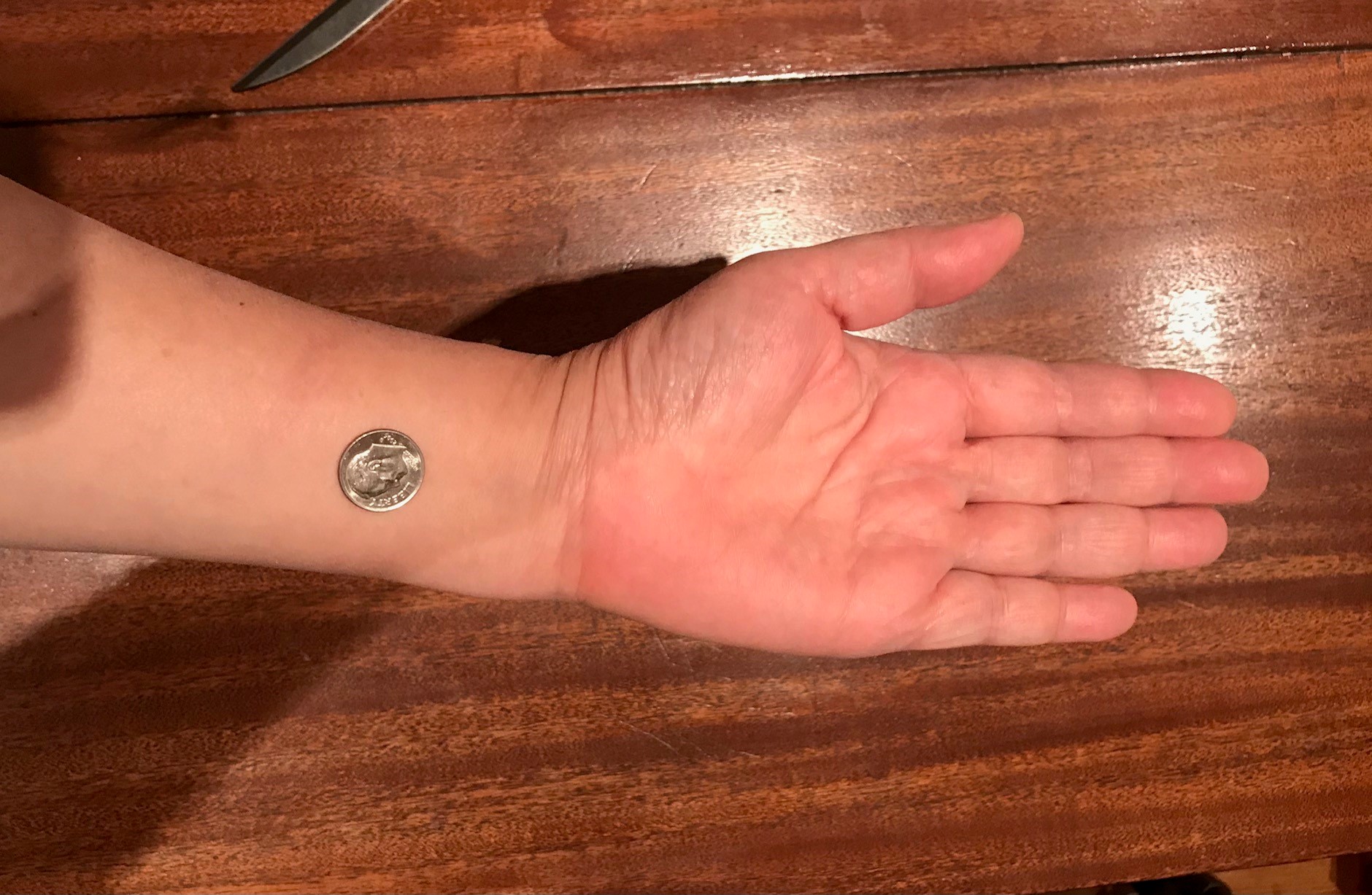An image of a hand with the naikan pressure point